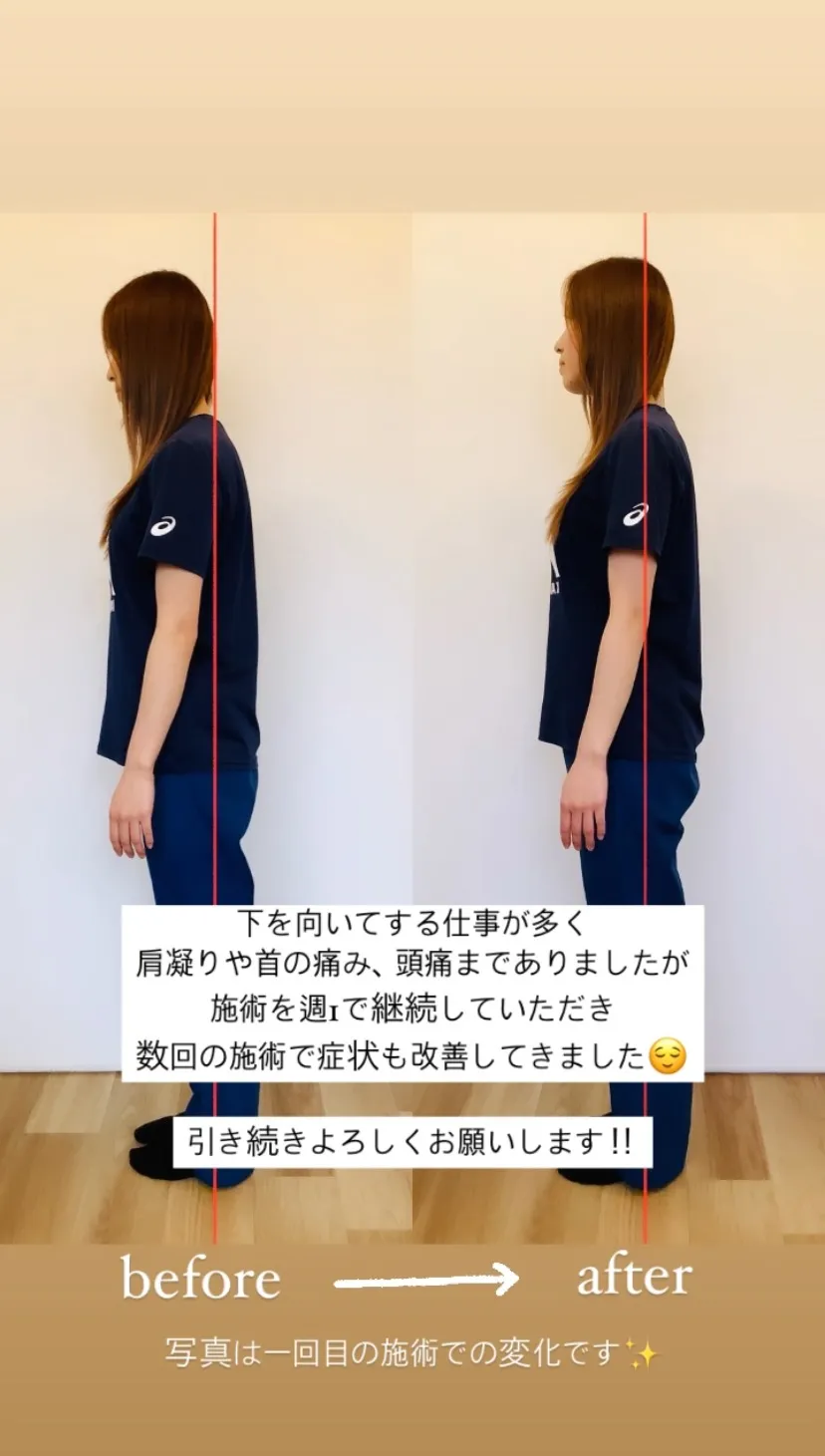 大人気！！姿勢矯正★