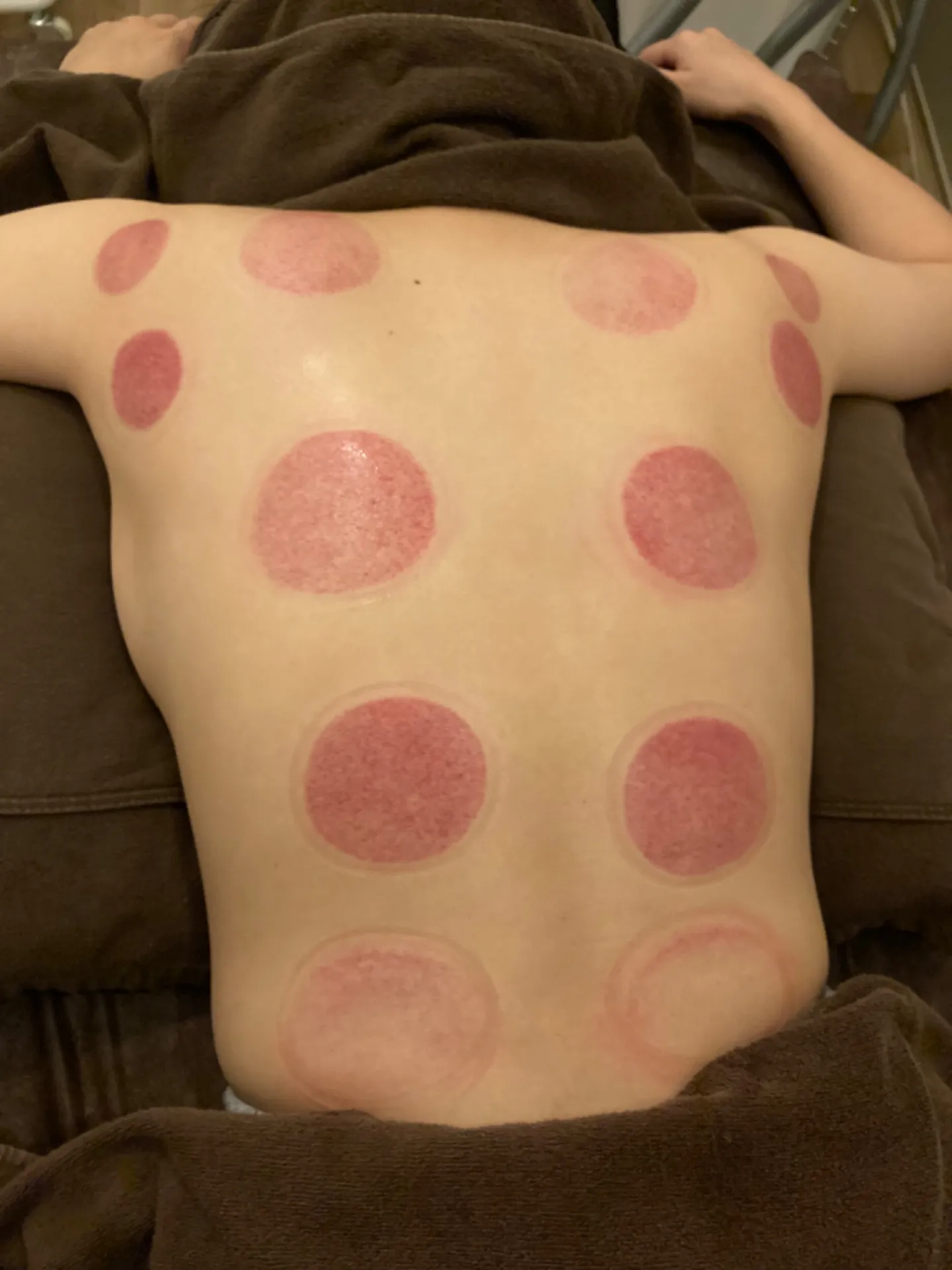 カッピング✨🫶